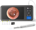 Ear Wax Removal Camera with 4.5 IPS Screen D529449
