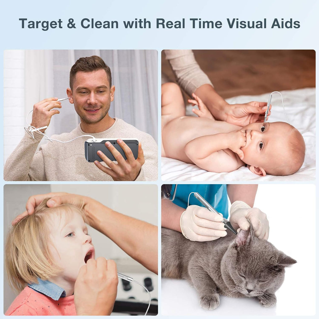 Ear Wax Removal Camera with 4.5 IPS Screen D529449